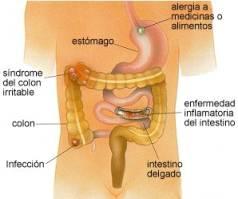 síntomas de la próstata y causa diarrea
